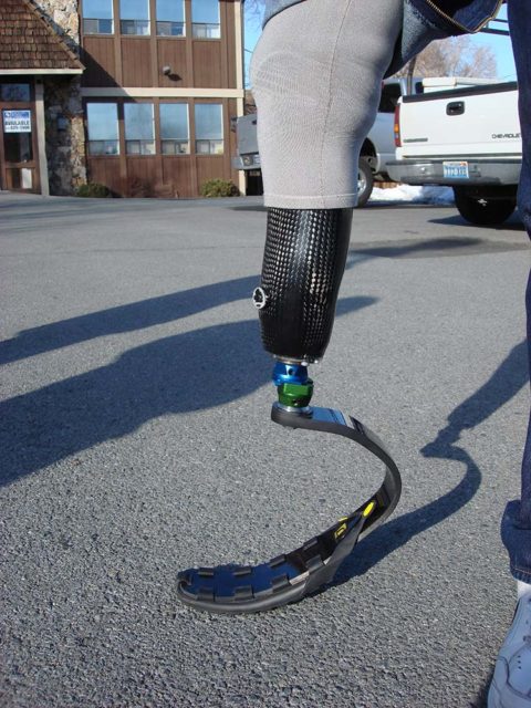 Prosthetics Services In Reno, NV | Forrester Custom Prosthetics